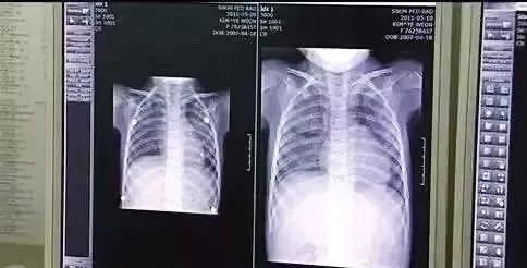 10个最容易忽视的家居隐患2019,家居常见的五大错误