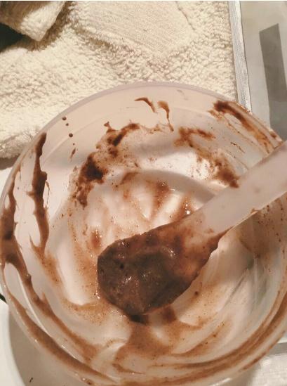 毛周角化中药调理治好了,重度汗管角化症最有效的治疗方法