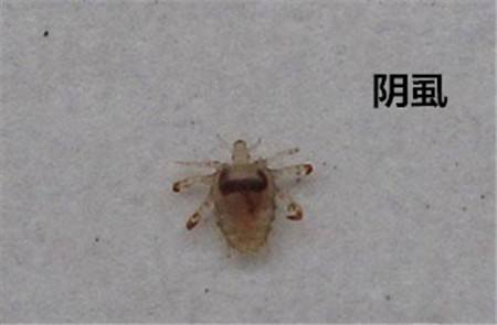 张医生讲传染疾病（一）：藏在男女私密部位的阴虱，最爱感染女性