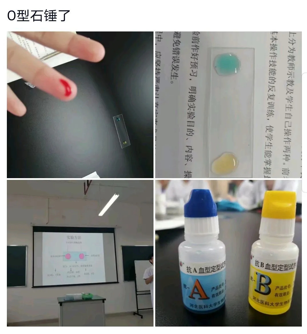 医学生学习打卡做题,医学生学习成果检验视频