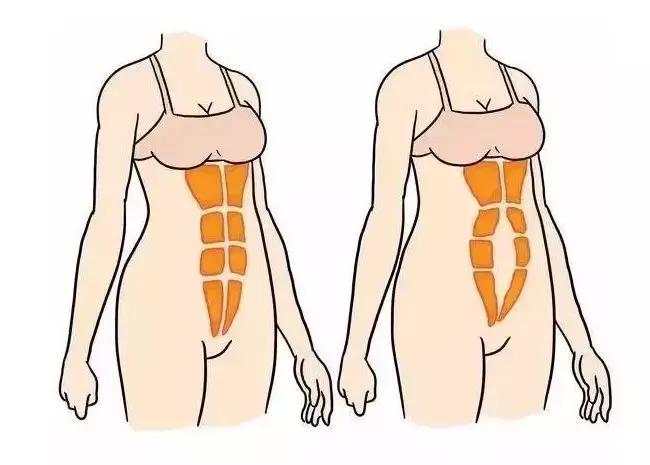 产后肚皮松像口袋一样,产后肚子松垮是腹直肌分离吗