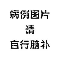辣眼睛！若私密部位出现浅红色赘生物赶紧治，它会一直传染不停歇