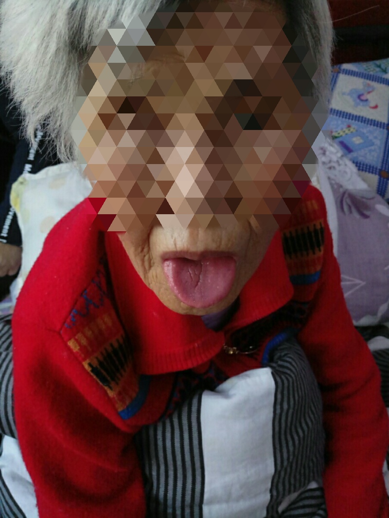 附子理中丸治疗心衰有奇效,治疗心衰用附子