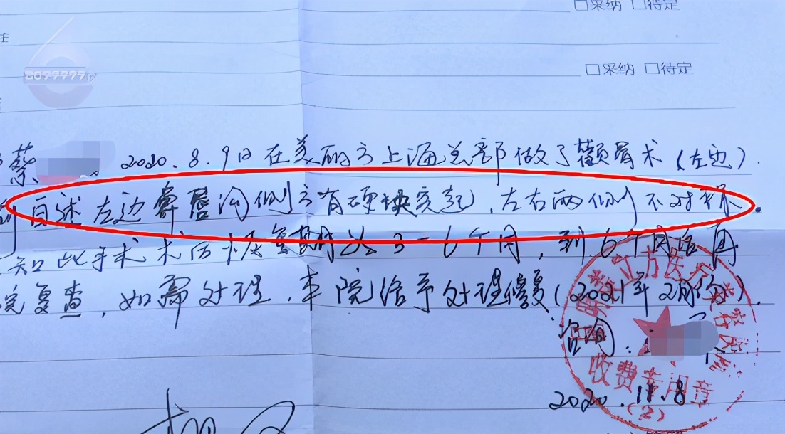 张嘴会响左右不对称!30岁小伙花三万“去颧骨”失败找院方协商还想再做手术