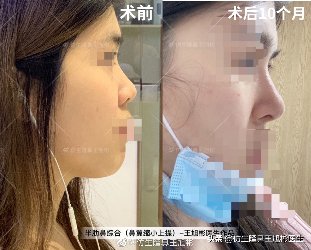 被鼻子封印的颜值,那些被鼻子封印的颜值