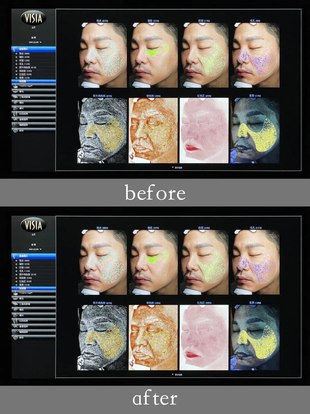 美肌‖他们要怎么做，才能让肤质显好不显老？