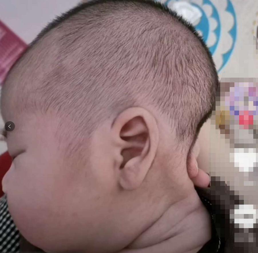 “大饼脸”宝宝，通常官配“平底锅”的后脑勺，宝宝脸大谁之错？