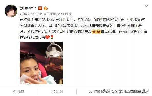 全明星都在做的烤瓷牙真的好吗,为什么明星全瓷牙要几百万