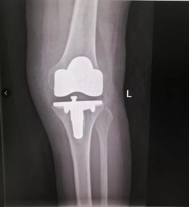 加速康复外科在国内的发展史,襄阳市中心医院康复科简介