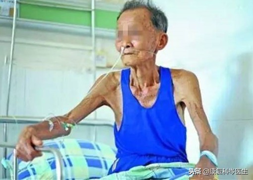 中风后吞咽困难治疗药物,中风后吞咽障碍多久可以恢复