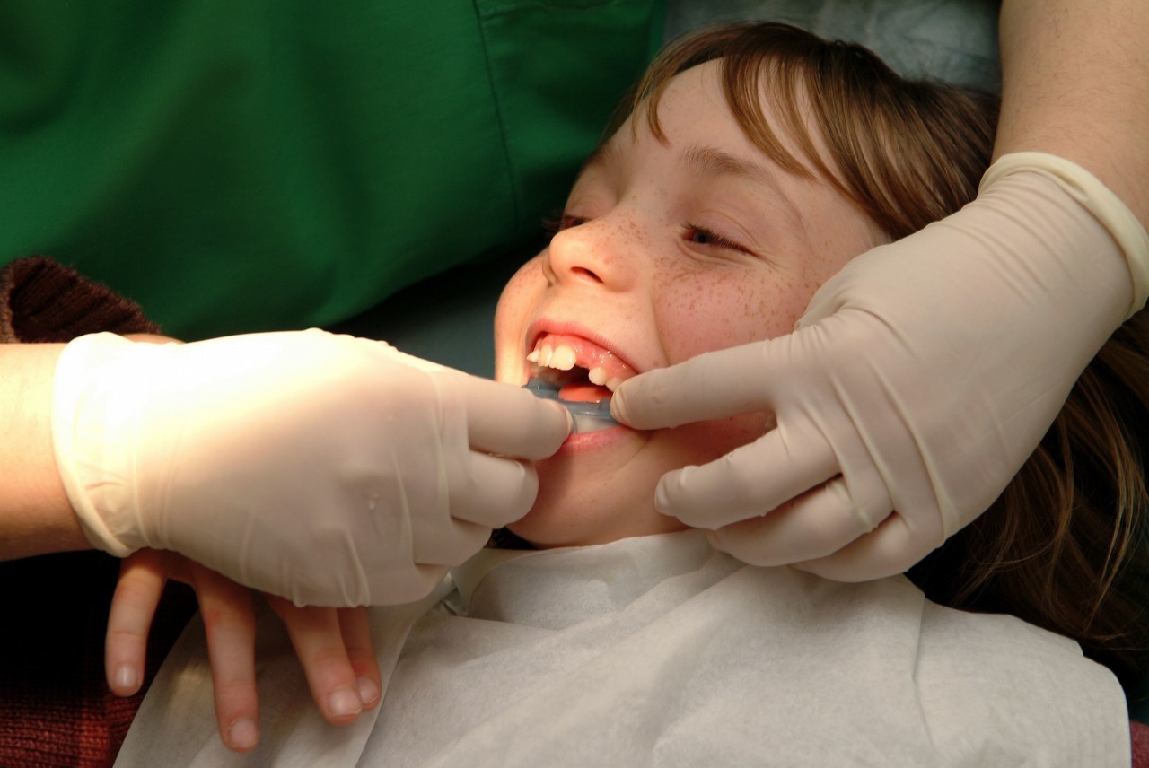 小孩乳牙不小心咽下去了怎么办,儿童乳牙摔松动了能自己恢复吗