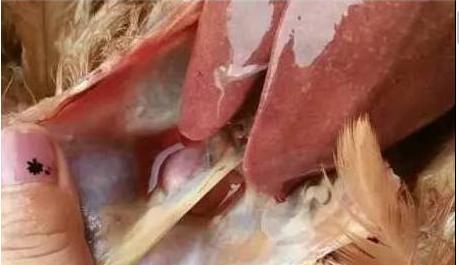 鸡气囊炎腹膜炎用哪种药治疗,大肠杆菌感染怎么缓解