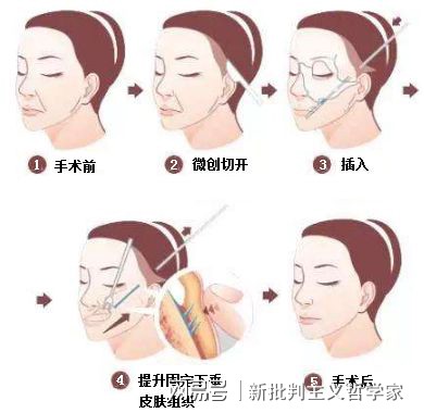 名医专访丨上海交通大学医学院附属同仁医院许瑾：面部美容整形