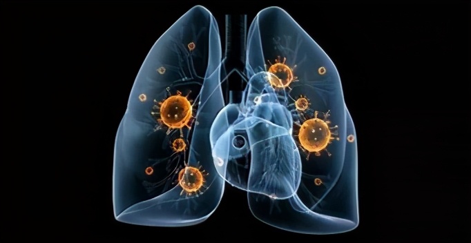 放疗期间可以吃中药调理,放疗后不良反应的护理方法