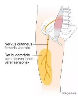 大腿前侧麻木，试试这个方法，干货来了