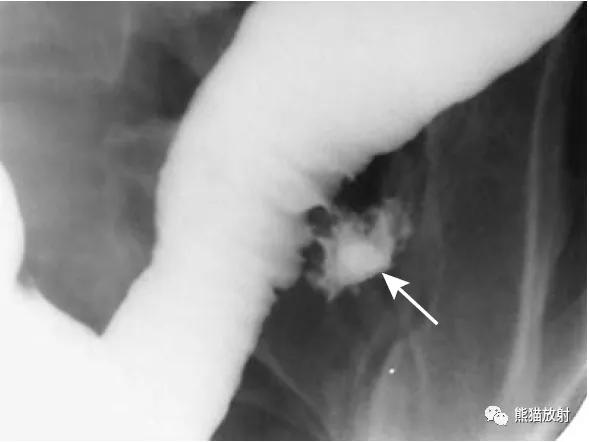 腹部影像图片大全,乙状直肠疼痛位置图片