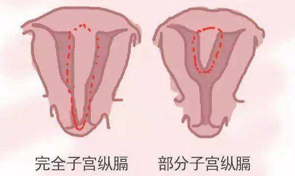拥有双子宫的女人可以怀孕吗？会影响正常生活吗？