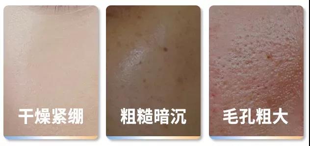 在空调屋里皮肤干燥、瘙痒、泛红，我来帮你解决