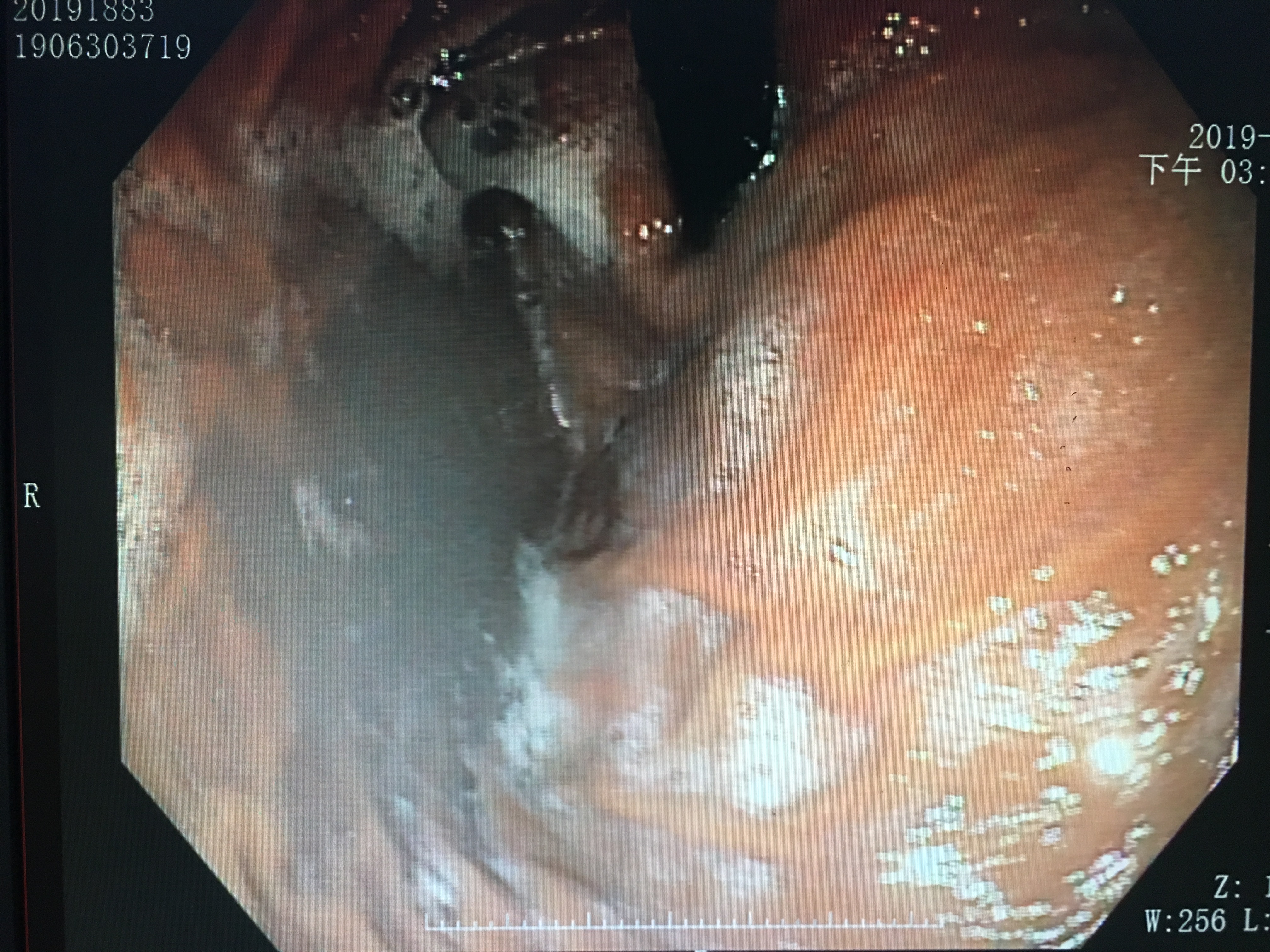 医生说的检查项目我们都必须做吗,医生告诉你应该做哪些检查