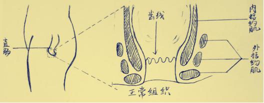 肛瘘拖着可以吗,肛周脓肿肛瘘手术多久可以恢复