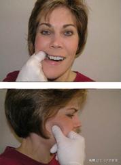 吃苹果张嘴侧面疼,别人吃苹果