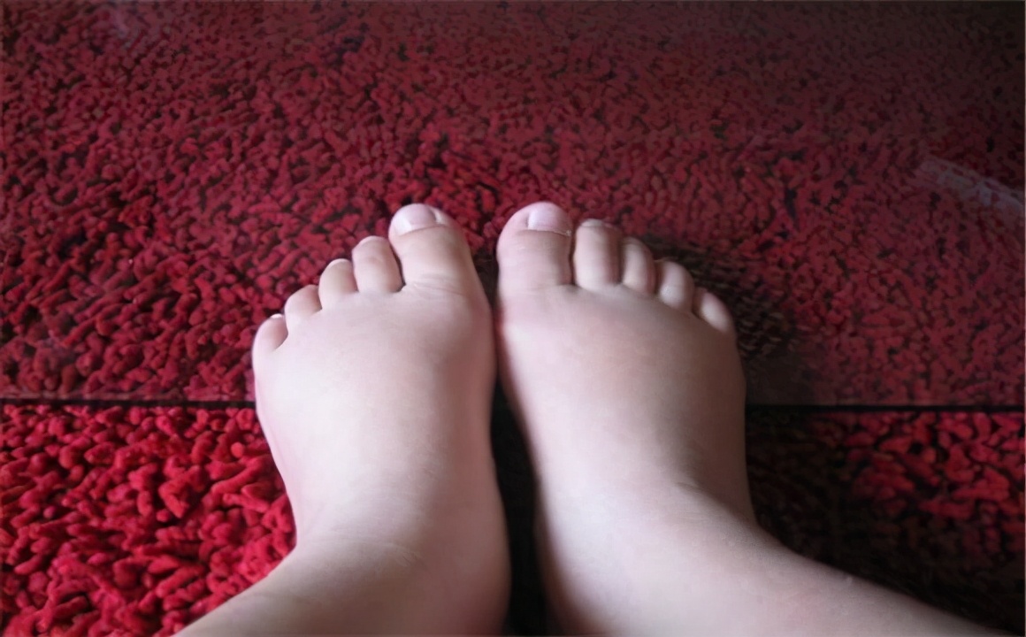 熊黛林晒照暴露生产后遗症,熊黛林产后100天照片