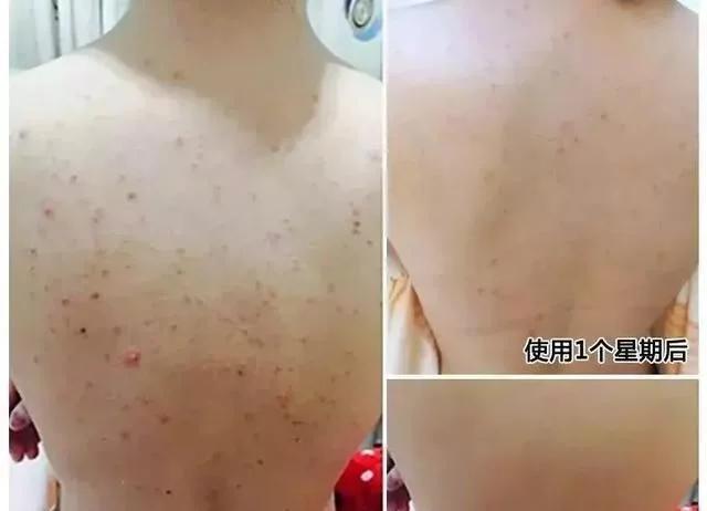 唐艺昕的皮肤怎么样,唐艺昕面部护理