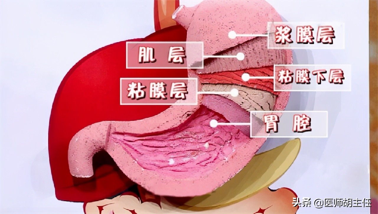 长期吃阿司匹林胃糜烂了怎么办呀,服用阿司匹林怎么保护胃粘膜