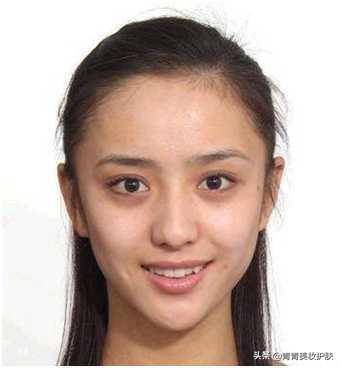 黑眼圈的类型及医美治疗方法,黑眼圈用什么方法拯救才好