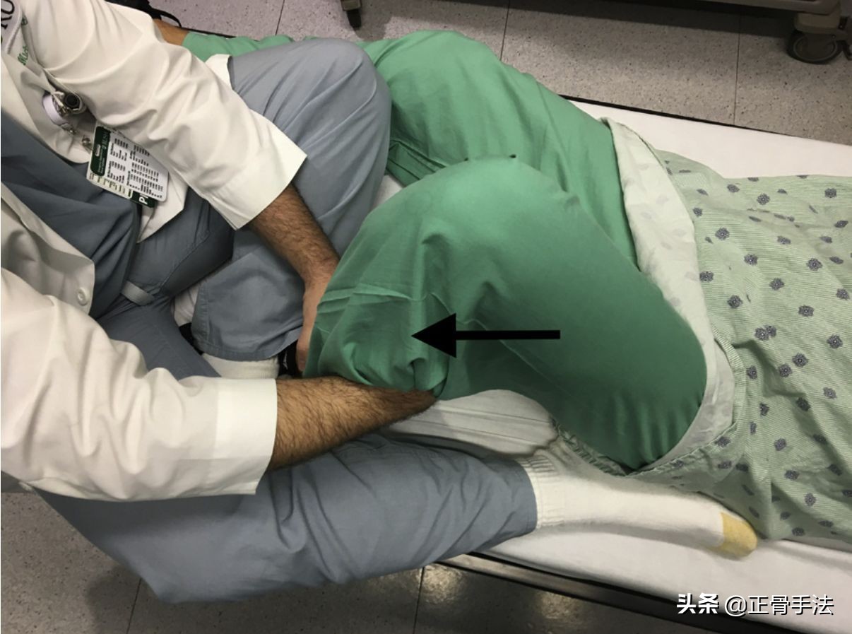 髋关节脱位正骨复位手法视频,髋关节脱位可以通过正骨复位吗