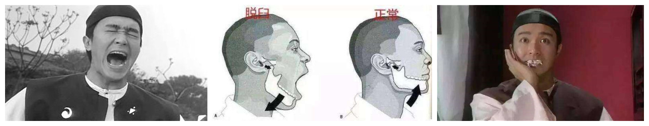 004.为什么很多人总是像王源哥哥一样掉下巴？