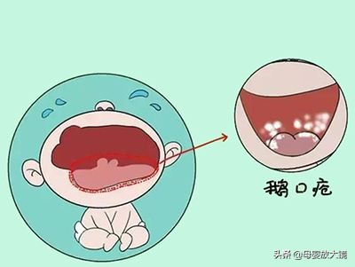 5月龄宝宝如何培养睡整觉,5月龄宝宝怎么训练睡眠好