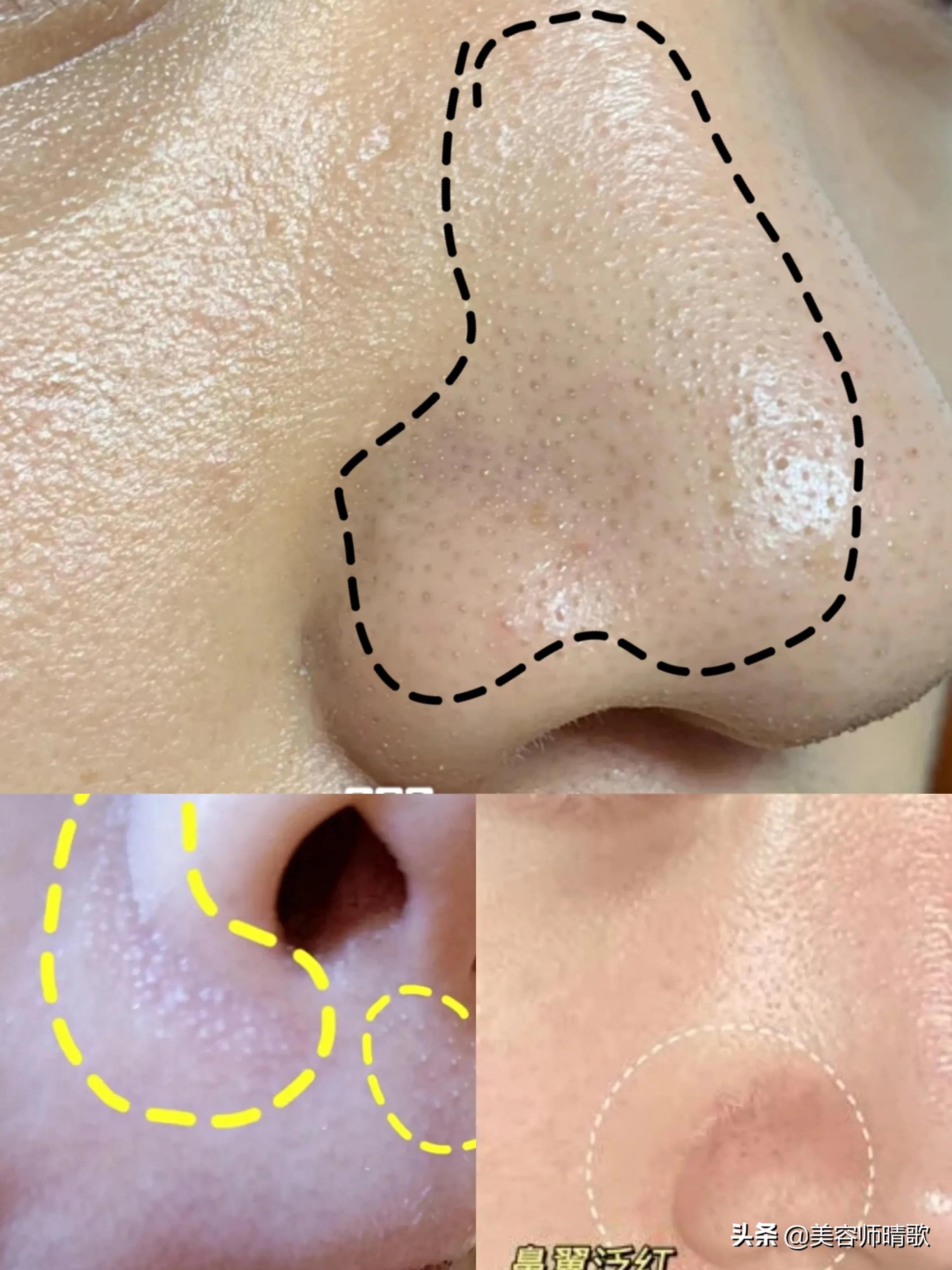 皮肤深层清洁美容院手法,美容院皮肤清洁的有效方法