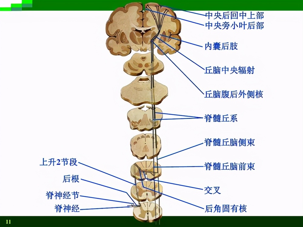 脊膜膨出与脊膜脊髓膨出,先天性脊髓脊膜膨出怎么治疗