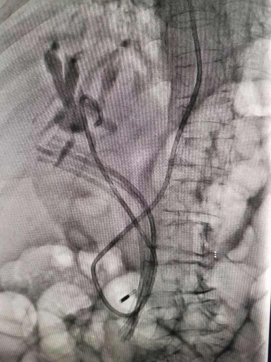 南大二附院红角洲分院具体位置,南大二附院红角洲分院优势