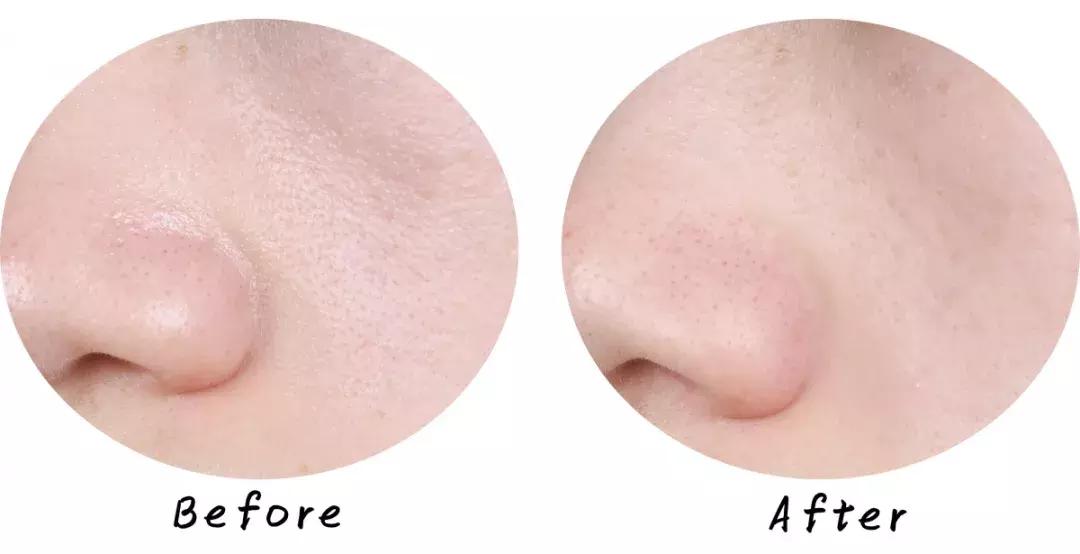 swisse麦卢卡蜂蜜排毒清洁面膜,超温和清洁面膜推荐哪个