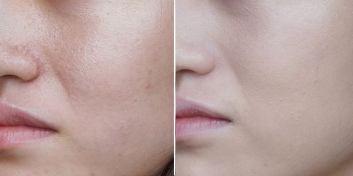 兰蔻气垫好用还是圣罗兰气垫好用,护肤气垫大牌