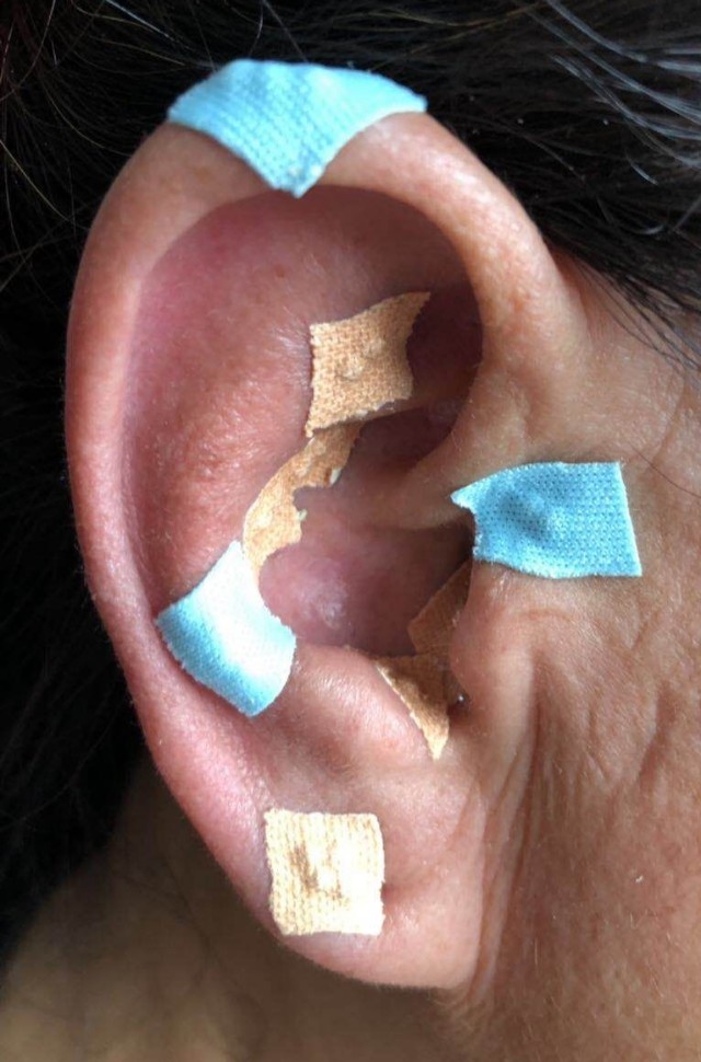 耳穴按摩养生法,气血疏通耳穴标准图片