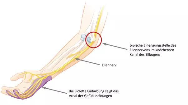 学葵花点穴手能防身吗,防身术点穴防身100招