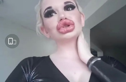 世界上最好看的嘴唇形状,世界最厚嘴唇的人嘴唇往外翻