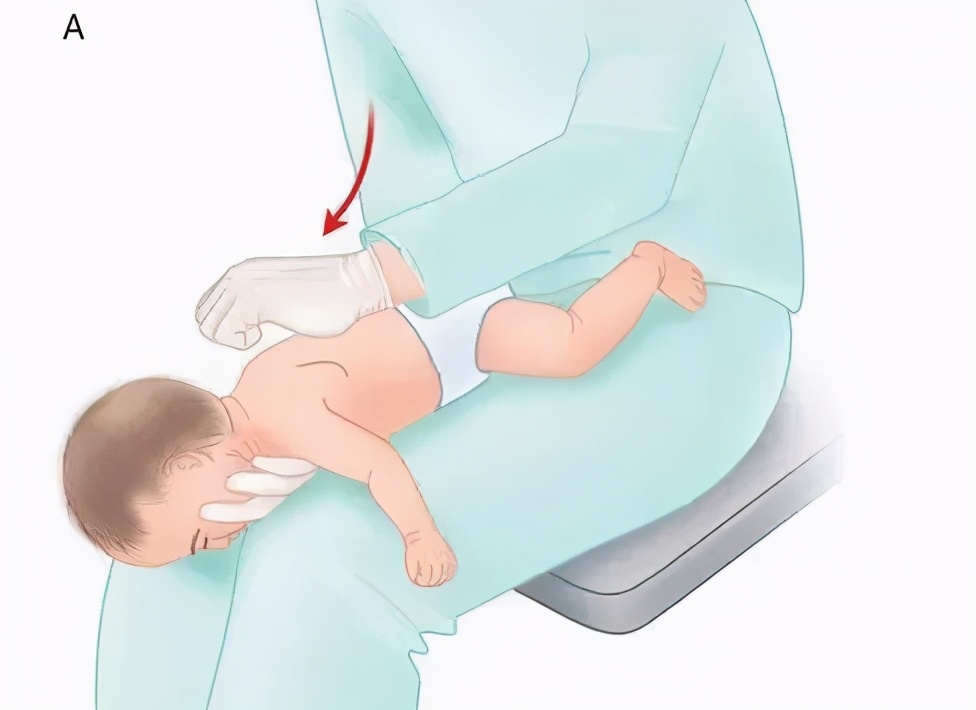 宝宝呛奶该如何快速处理,宝宝呛奶了要怎么处理才有效