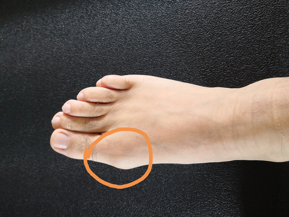 尿酸高用什么泡水喝好得快,尿酸高可以用食用小苏打兑水喝吗