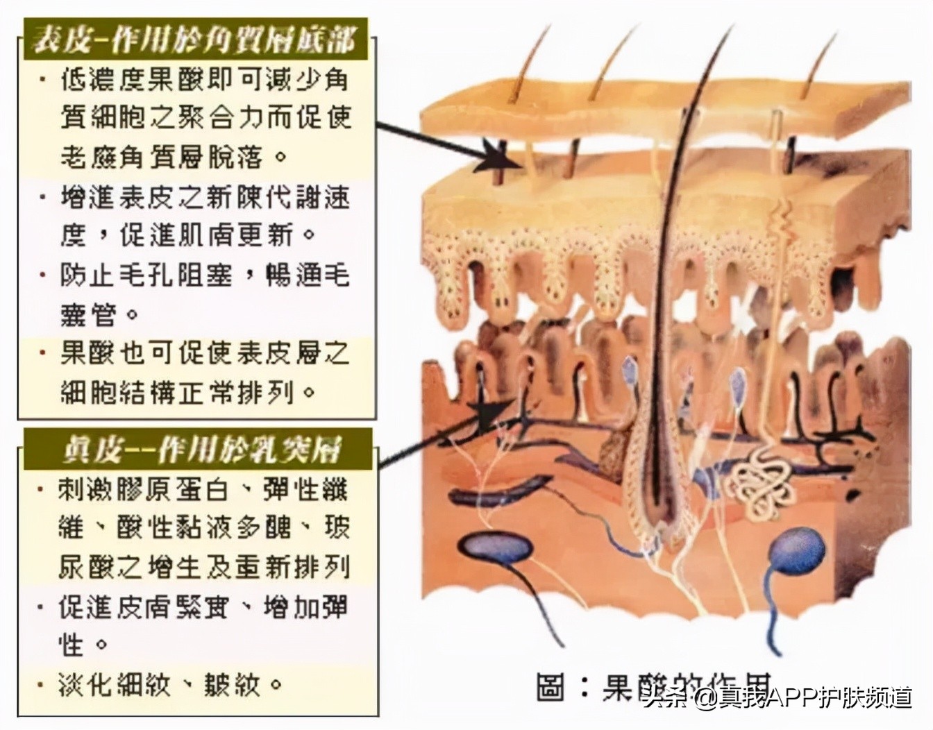 刷酸爆闭口要不要继续刷,刷酸祛闭口几天能有效果