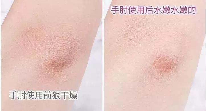 脚后跟老茧怎么去除,我的脚后跟有老茧变硬有细微开裂