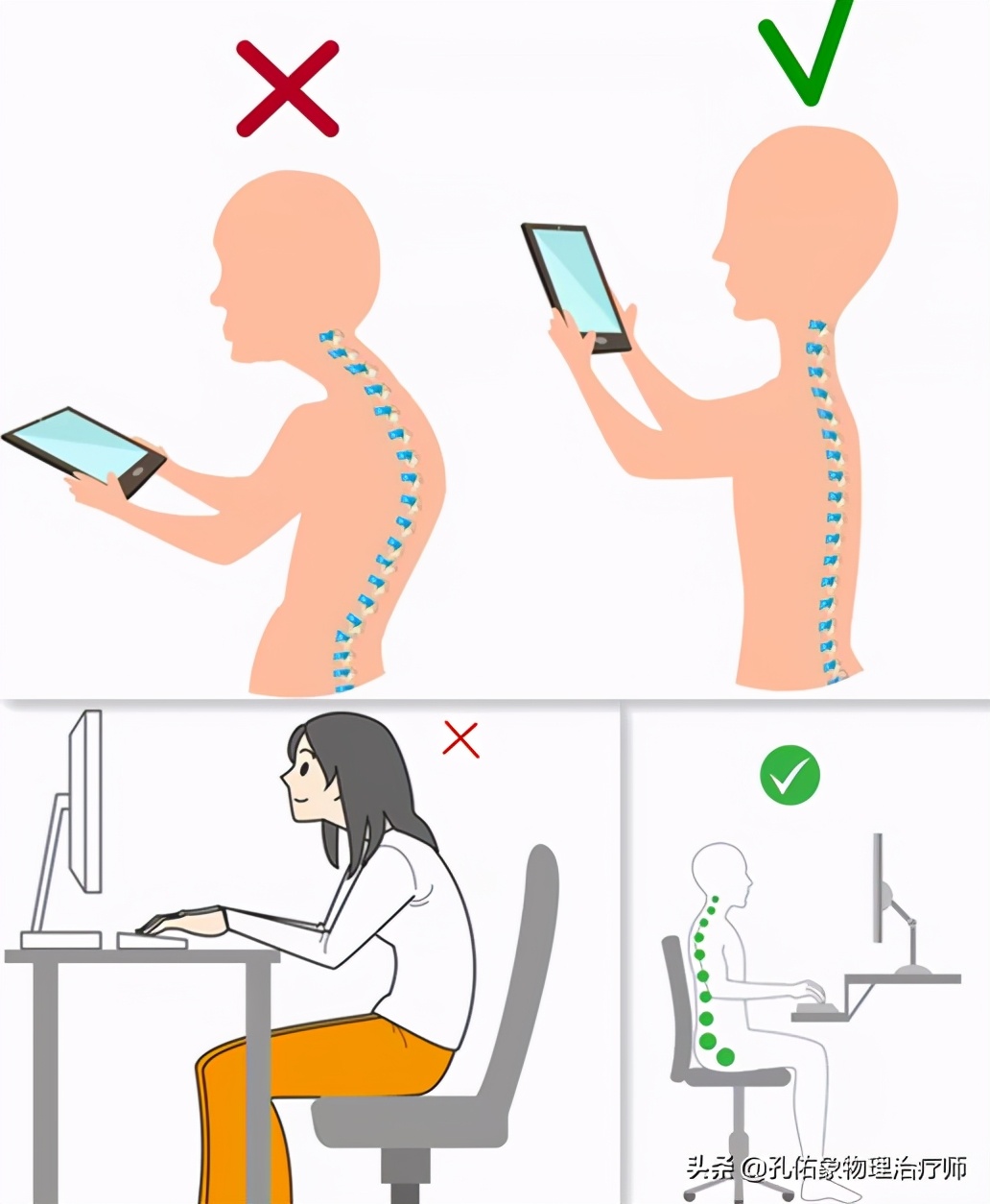 肩颈颈椎痛怎么缓解最快最有效,颈椎病最怕的5个症状