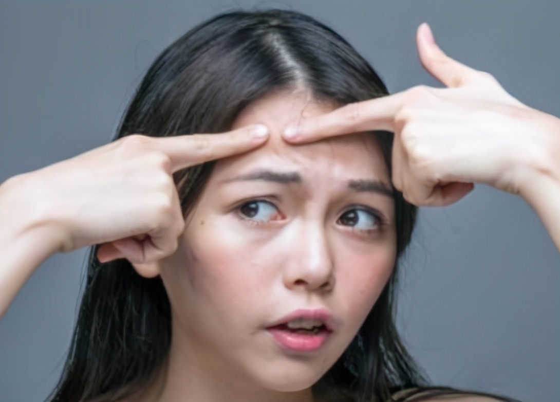 18岁脸上长痘的少女用什么护肤品,30多岁脸上反复长痘用什么护肤品