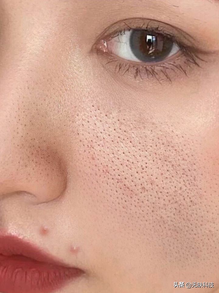 不管黑头的后果,不管黑头行吗