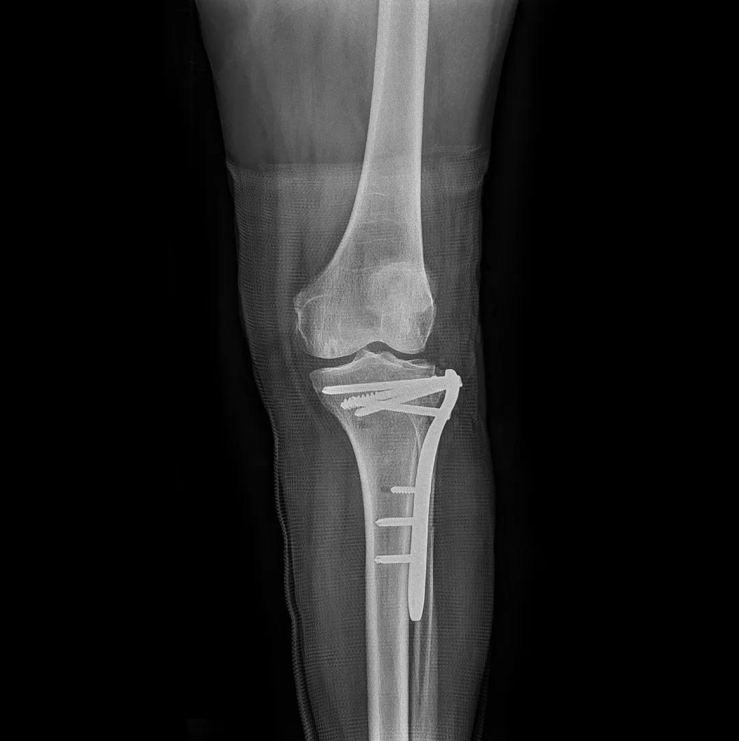 安健科技dr拍片质量怎么样,安健科技DR价格