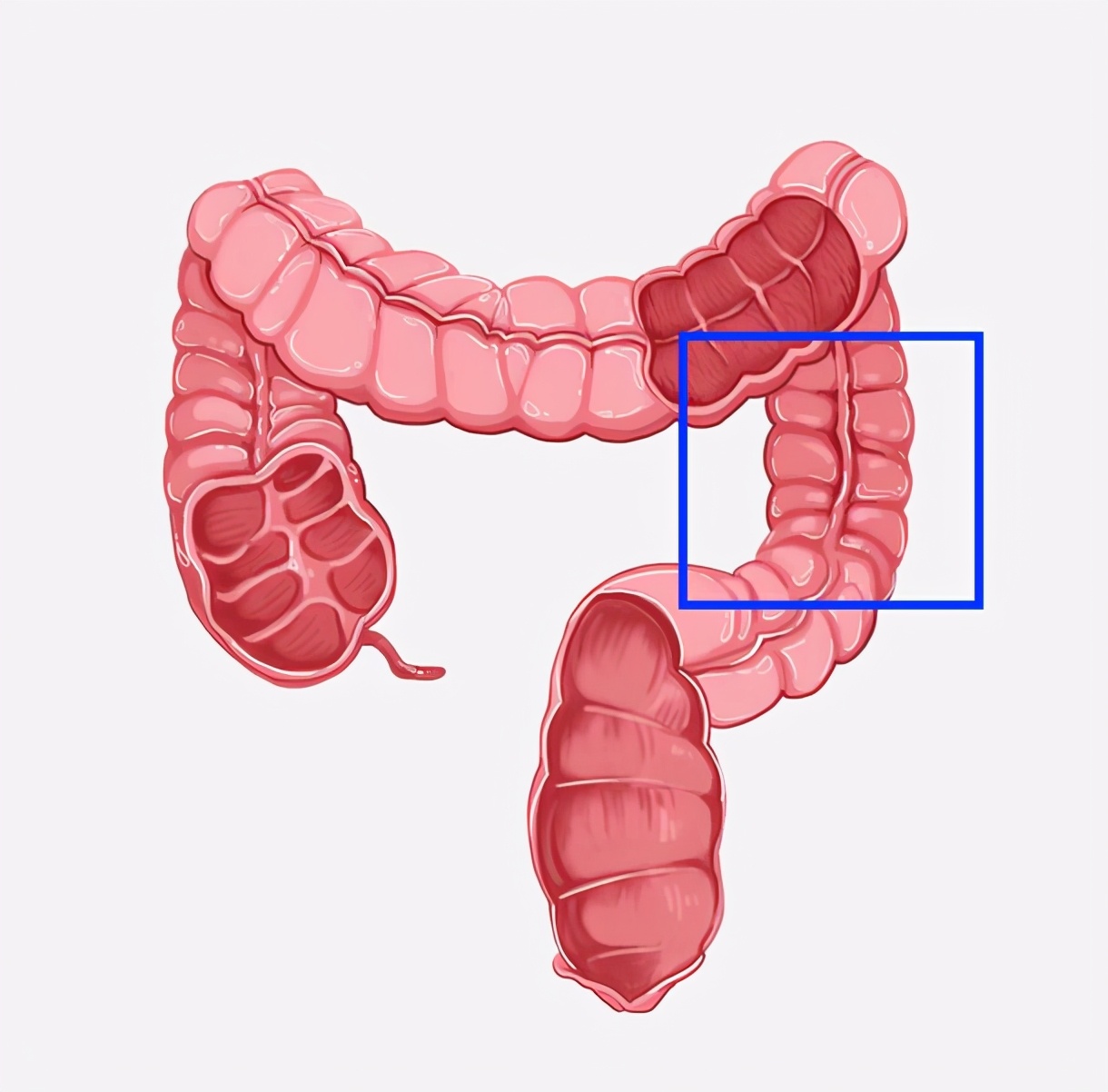 一张腹部地图了解腹痛,一张图让你知道腹部哪里疼