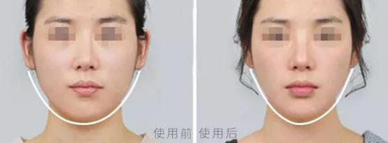 大长今宋慧乔金喜善,大长今金喜善宋慧乔